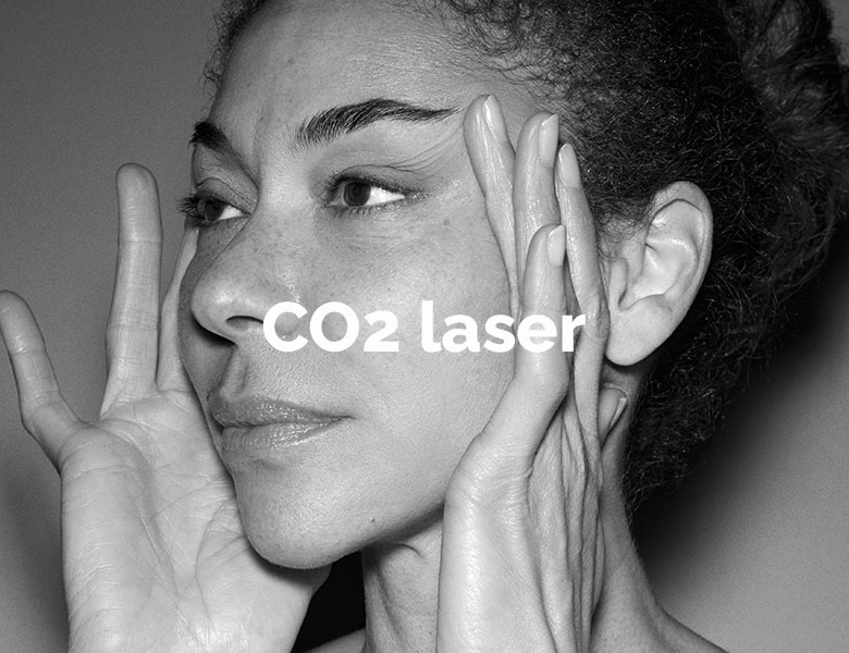 co2 laser